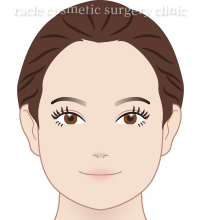 エラ(小顔ボトックス) イメージ