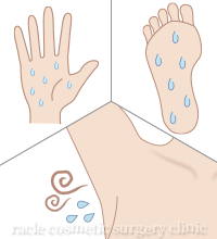 ワキガ・多汗症ボトックス イメージ