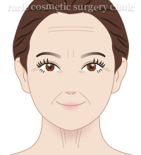 顔、首のシワ イメージ