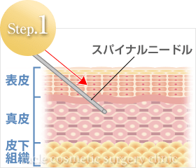 糸の挿入方法 Step.1