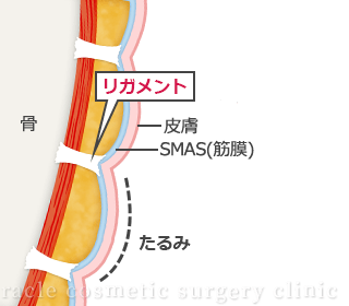 たるみのある皮膚の断面図イメージイラスト