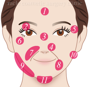 顔 治療部位イメージ