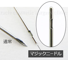 マジックニードル イメージ