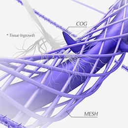 テスリフトソフトノーズの糸イメージ図