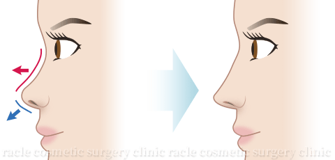 n-COG Y-ko 施術効果イメージ