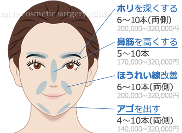 Gメッシュ 適応部位 イメージ