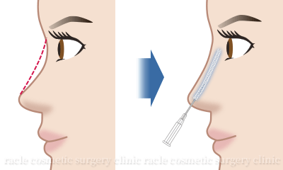 Gメッシュ 適応部位 イメージ