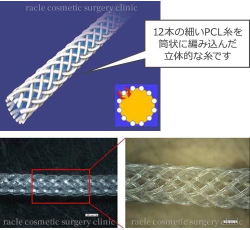 Gメッシュ PCL糸 イメージ