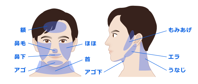 男性用医療レーザーの部位 イメージ