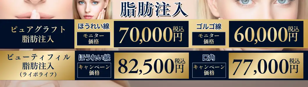 おすすめ治療 脂肪注入バナー